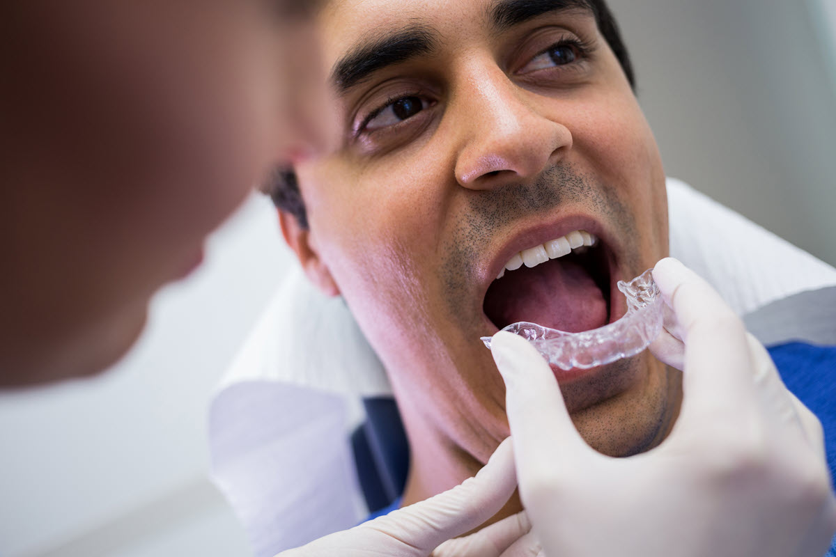 Dental Implants